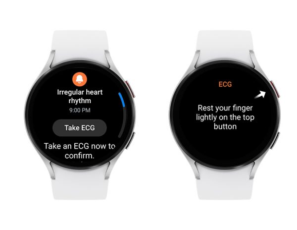 two watches showing Samsung Galaxy's irregular heart rhythm notifications