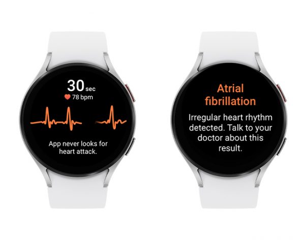 two watches showing Samsung Galaxy's irregular heart rhythm notifications
